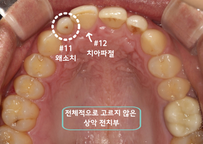 라미네이트