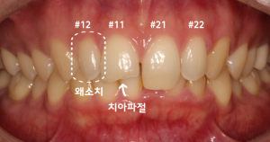라미네이트