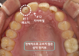 라미네이트