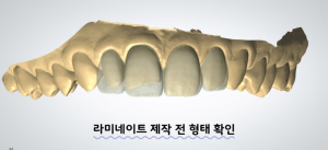 라미네이트
