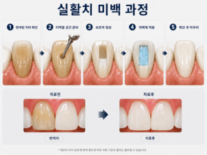 실활치 미백과정을 설명한 이미지